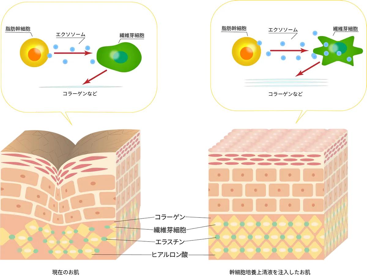 美容効果の違い図